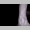Setup1_wrist10_7in.bmp