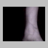 Setup1_wrist5_9in.jpg