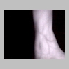 Setup1_wrist6_8in.jpg