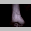 Setup1_wrist8_6in.bmp